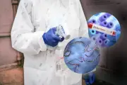 OMS alerta por rápida propagación de ébola en Congo: 131 muertos