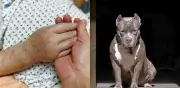 Ataque brutal de perros deja a mujer sin varios dedos en Montebello, Antioquia