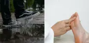 ¿Es peligroso pisar charcos de lluvia? Expertos responden sobre hongos y humedad