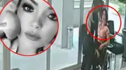Influencer muere tras procedimiento estético con PMMA en Brasil